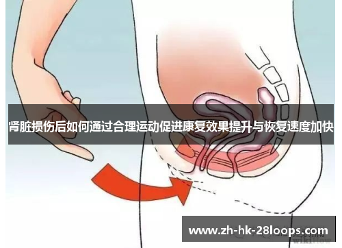 肾脏损伤后如何通过合理运动促进康复效果提升与恢复速度加快 肾脏损伤后如何通过合理运动促进康复效果提升与恢复速度加快
